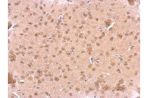 IHC-P Image ARF3 antibody detects ARF3 protein at cytosol on mouse fore brain by immunohistochemical analysis.