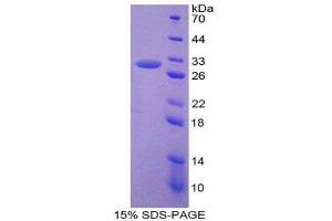 SDS-PAGE (SDS) image for Activating Transcription Factor 1 (AFT1) (AA 3-245) protein (His tag) (ABIN1879713) (AFT1 Protein (AA 3-245) (His tag))