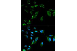 Immunofluorescence analysis of HeLa cell using NEK8 antibody. (NEK8 anticorps  (AA 1-300))
