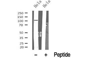 Western blot analysis of PRK1/2 in lysates of Hela? (PRK1/2 anticorps)