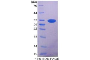 SDS-PAGE analysis of Rat Lipase, Pancreatic Protein. (Lipase Protéine)