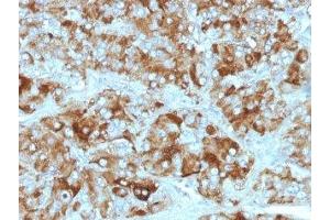 Formalin-fixed, paraffin-embedded adrenal gland stained with Chromogranin A antibody cocktail