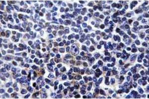 Immunohistochemistry (IHC) analyzes of p-Paxillin (pTyr31) antibody in paraffin-embedded human tonsil tissue. (Paxillin anticorps  (pTyr31))