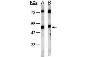 WB Image Sample(30 μg of whole cell lysate) A:HeLa S3, B:MOLT4, 10% SDS PAGE antibody diluted at 1:1000 (GRPR anticorps)