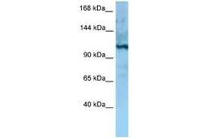 Image no. 1 for anti-MORC Family CW-Type Zinc Finger 4 (MORC4) (AA 747-796) antibody (ABIN6748258) (MORC4 anticorps  (AA 747-796))