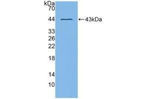 Western blot analysis of recombinant Mouse ADAM8. (ADAM8 anticorps  (AA 145-493))