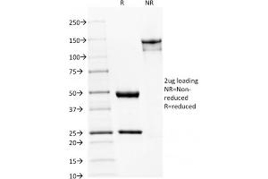 SDS-PAGE Analysis Purified Spectrin beta III Mouse Monoclonal Antibody (SPTBN2/1582).