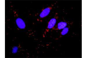 Proximity Ligation Analysis of protein-protein interactions between TP53 and MDM2.
