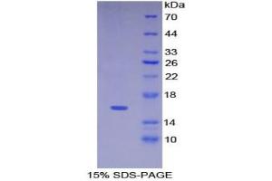 SDS-PAGE of Protein Standard from the Kit (Highly purified E.