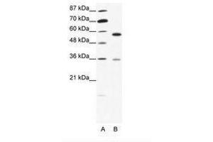 Image no. 1 for anti-GDP Dissociation Inhibitor 1 (GDI1) (C-Term) antibody (ABIN202545) (GDI1 anticorps  (C-Term))