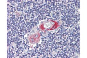 Anti-CPXCR1 antibody IHC staining of human thymus. (CPXCR1 anticorps  (Middle Region))