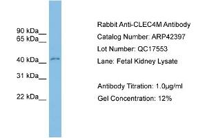WB Suggested Anti-CLEC4M Antibody Titration:  0.