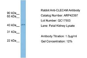 WB Suggested Anti-CLEC4M Antibody Titration:  0. (C-Type Lectin Domain Family 4, Member M (CLEC4M) (Middle Region) anticorps)