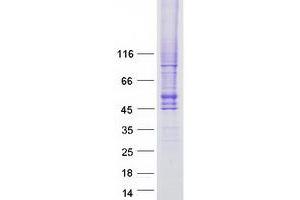 Validation with Western Blot