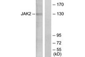 Western blot analysis of extracts from HT-29 cells, using JAK2 (Ab-1007) Antibody. (JAK2 anticorps  (AA 981-1030))