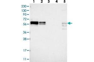 Western blot analysis of Lane 1: RT-4, Lane 2: U-251 MG, Lane 3: Human Plasma, Lane 4: Liver, Lane 5: Tonsil with ZC3H15 polyclonal antibody . (ZC3H15 anticorps)