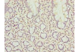Immunohistochemistry of paraffin-embedded human small intestine tissue using ABIN7168517 at dilution of 1:100