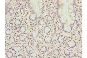 Immunohistochemistry of paraffin-embedded human small intestine tissue using ABIN7168517 at dilution of 1:100 (SCAPER anticorps  (AA 1109-1400))