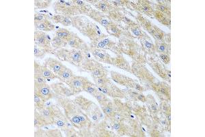 Immunohistochemistry of paraffin-embedded human liver using UCHL3 antibody at dilution of 1:100 (40x lens). (UCHL3 anticorps)