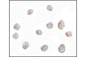 Immunocytochemistry of LIS1 in Jurkat cells with this product at 2.