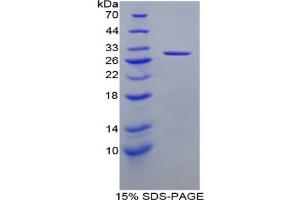 SDS-PAGE analysis of Rat DLD Protein.