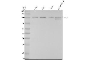 Western blot analysis of CENPC using anti-CENPC antibody (ABIN7604417).