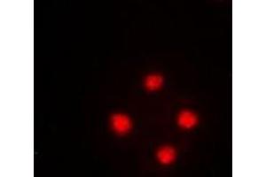 Immunofluorescent analysis of SRSF5 staining in HeLa cells.