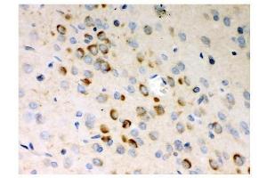 IHC analysis of Stathmin 1 using anti-Stathmin 1 antibody (ABIN3043301). (Stathmin 1 anticorps  (N-Term))