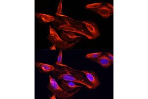 Immunofluorescence analysis of U2OS cells using MMP2 antibody (ABIN6129300, ABIN6143910, ABIN6143912 and ABIN6215078) at dilution of 1:100. (MMP2 anticorps  (AA 40-280))