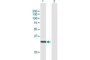 Western Blot analysis of ZFAND3 expression in transfected 293T cell line by ZFAND3 MaxPab polyclonal antibody.