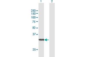 Western Blot analysis of ZFAND3 expression in transfected 293T cell line by ZFAND3 MaxPab polyclonal antibody. (ZFAND3 anticorps  (AA 1-227))
