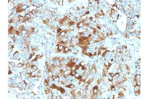 Formalin-fixed, paraffin-embedded human Adrenal Gland stained with Chromogranin A Monoclonal Antibody (CHGA/765). (Chromogranin A anticorps)