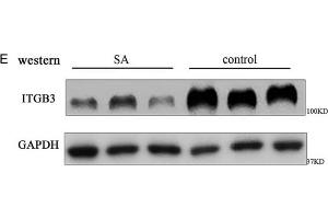 The expressions of H19 and integrin β3 (ITGB3) decrease in human embryonic chorion tissue of spontaneous abortion. (GAPDH anticorps)