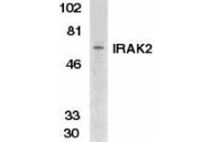 Western blot analysis of IRAK2 in K562 whole cell lysate with AP30441PU-N IRAK2 antibody at 1/500 dilution. (IRAK2 anticorps  (C-Term))