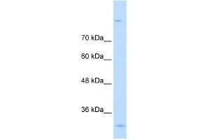 WB Suggested Anti-MPPED2 Antibody Titration:  0. (MPPED2 anticorps  (C-Term))