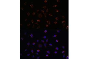 Immunofluorescence analysis of L929 cells using KIF5B Rabbit pAb (ABIN7268136) at dilution of 1:100 (40x lens).