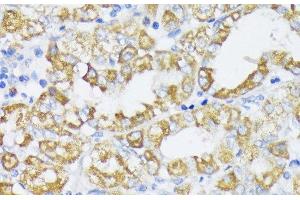 Immunohistochemistry of paraffin-embedded Human stomach using SLC30A1 Polyclonal Antibody at dilution of 1:100 (40x lens). (SLC30A1 anticorps)