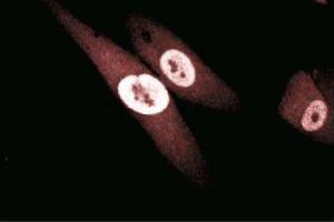 Immunofluorescence staining of human fibroblasts. (GSTP1 anticorps  (AA 5-210))