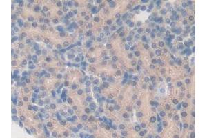 DAB staining on IHC-P; Samples: Rat Kidney Tissue (CYP27B1 anticorps  (AA 251-500))