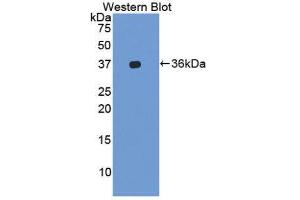 Western Blotting (WB) image for anti-Integrin alpha-L (ITGAL) (AA 809-1066) antibody (ABIN1859650) (ITGAL anticorps  (AA 809-1066))