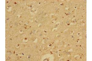 Immunohistochemistry of paraffin-embedded human brain tissue using ABIN7163532 at dilution of 1:100
