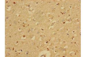 Immunohistochemistry of paraffin-embedded human brain tissue using ABIN7163532 at dilution of 1:100 (PAI1 anticorps  (AA 24-398))