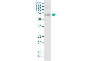 PHF1 monoclonal antibody (M04), clone 2G7.