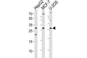 Western blot analysis of lysate from HepG2, MCF-7, U-2OS cell line (left to right) using ID1 antibody; Ab was diluted at 1:1000 for each lane.