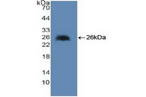 Western blot analysis of recombinant Human cPLA2. (PLA2G4A anticorps  (AA 1-178))