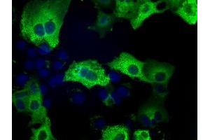 Image no. 1 for anti-Transforming, Acidic Coiled-Coil Containing Protein 3 (TACC3) antibody (ABIN1498100)