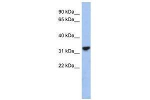 CYC1 antibody used at 1 ug/ml to detect target protein. (Cytochrome C1 anticorps  (Middle Region))