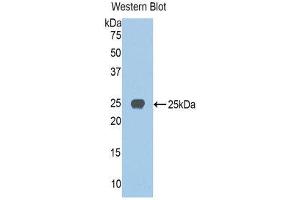 Western Blotting (WB) image for anti-Jagged 1 (JAG1) (AA 836-1047) antibody (ABIN1859518) (JAG1 anticorps  (AA 836-1047))