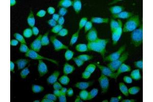 IF analysis of CPN1 using anti-CPN1 antibody (ABIN7600158).