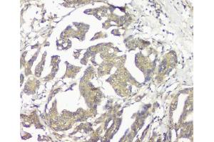 IHC analysis of GNAQ using anti GNAQ antibody (ABIN6719526).